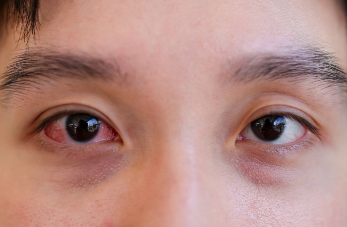 Diagnosing 8 Types of Eye Conditions