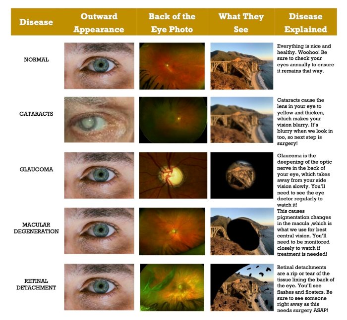 Diagnosing 8 Types of Eye Conditions